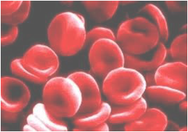 pernicious-anemia